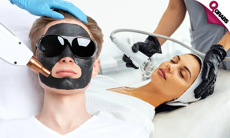 Carbon Peel, Scalp Hydrafacial, & RF Microneedling!